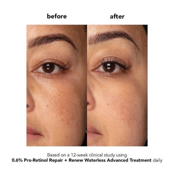 Boscia 0.6% Pro-Retinol Repair & Renew Waterless Advanced Treatment - Picture 3 of 10